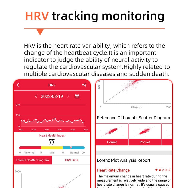 Bloeddruk-smartwatch met hartslagmeter, ronde wijzerplaat, gezondheidsregistratie, verstelbaar, ECG